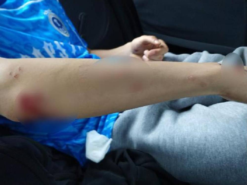 Köpeklerin saldırdığı lise öğrencisi yaralandı