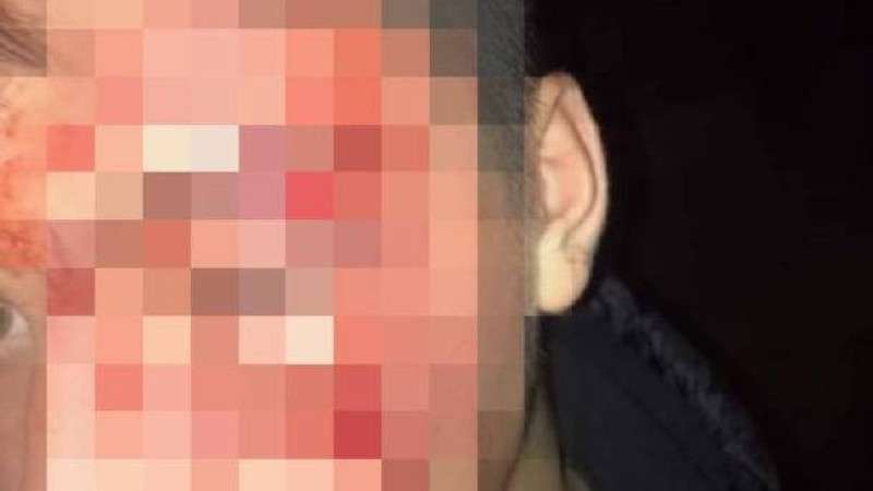 G&Ouml;R&Uuml;NT&Uuml;LERİ &Ccedil;EKEN &Ouml;ĞRENCİ SOKAKTA SALDIRIYA UĞRADI